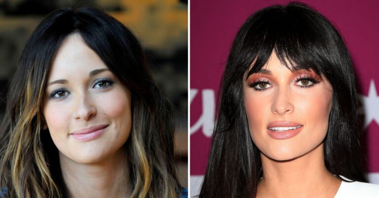 Kacey Musgraves Transformation and Plastic Surgery Speculation: Photos