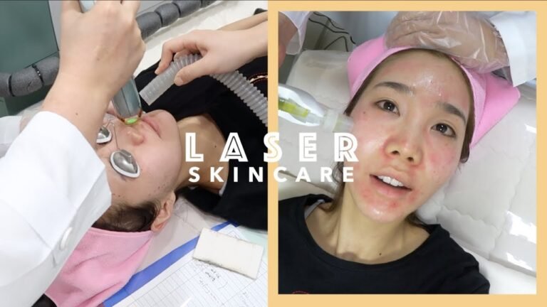 Laser Skincare Treatment in Korea: Acne Scars, Freckles, & Facial Hair Removal