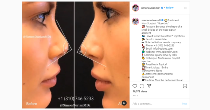 Micro-Droplet Injection: Simon Ourian’s Revolutionary No Surgery Nose Job Technique