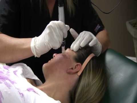 Skin Rejuvenation Facial Treatment using Dermapen | Dr. Johnsen