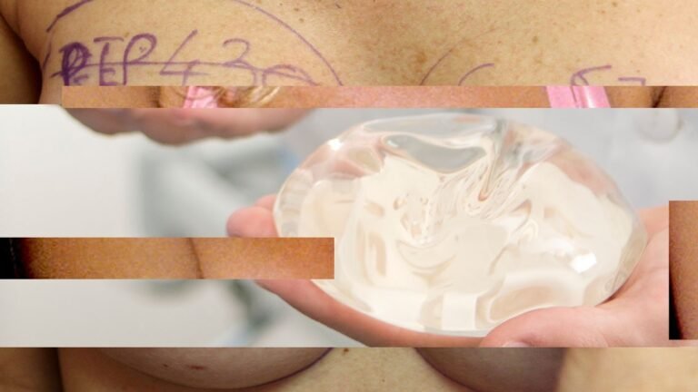 How Breast Implants Have Changed in the Past 30 Years