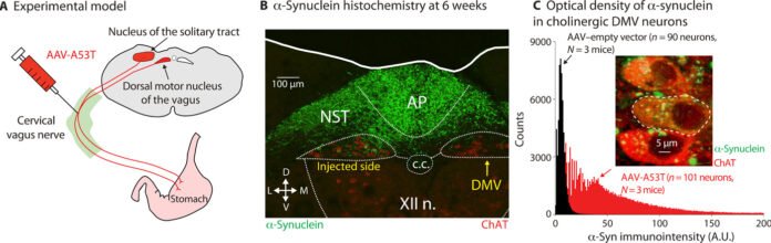 α-Synuclein–induced Kv4 channelopathy in mouse vagal motoneurons drives nonmotor parkinsonian symptoms