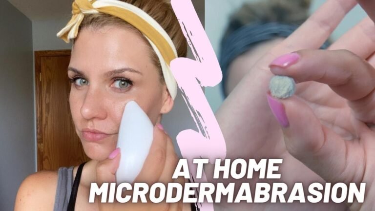 BEST FACIAL TREATMENT AT HOME | Microderm Glo Diamond Kit Review