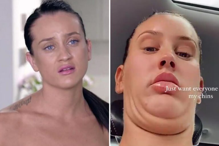 MAFS Australia’s Ines Basic is unrecognisable from her usual glam self as she shows off her ‘chins’