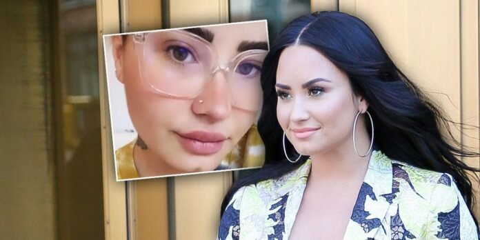 Did Singer Demi Lovato Get Lip Fillers? Plastic Surgeons Weigh In
