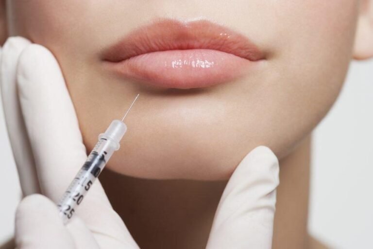 Everything you’ve ever wanted to know about lip injections