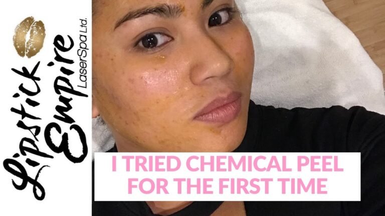 I Tried Chemical Peel Facial Treatment For The First Time – Lipstick Empire Laser Spa Edmonton