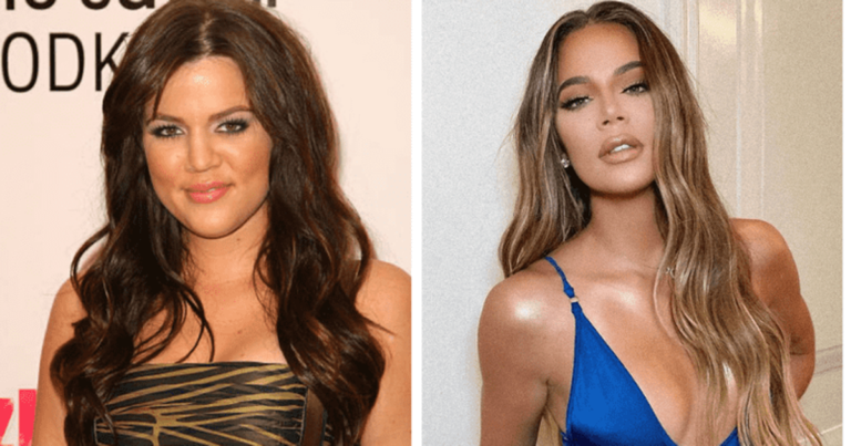 Khloe Kardashian’s plastic surgeries: Rhinoplasty to fillers, all the cosmetic procedures ‘KUWTK’ star got done