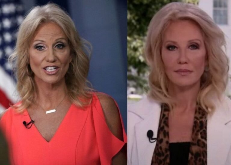 Plastic Surgeon Weighs In On Kellyanne Conway’s Makeover — Did She Go Under The Knife?