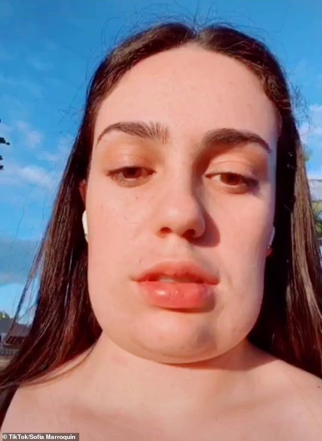 BEFORE: A 19-year-old from Australia was left with a 'face like a rectangle' after a $500 cosmetic procedure, which uses injections to reduce fat under the chin