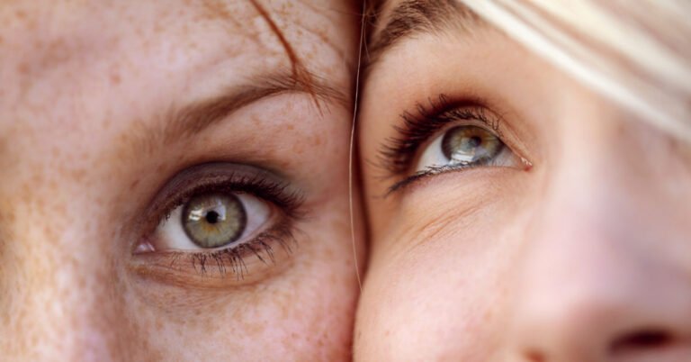 Veins Under Eyes: Causes & Treatment Options