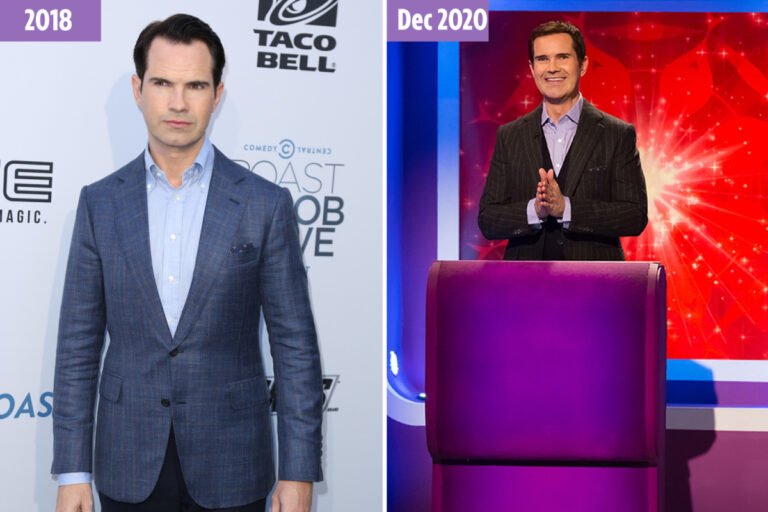 Jimmy Carr reveals dramatic transformation after getting a hair transplant, botox and veneers to match his TV appearance