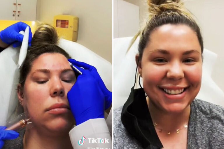 Teen Mom Kailyn Lowry posts a clip of herself getting anti-wrinkle injections after fans beg her to STOP plastic surgery