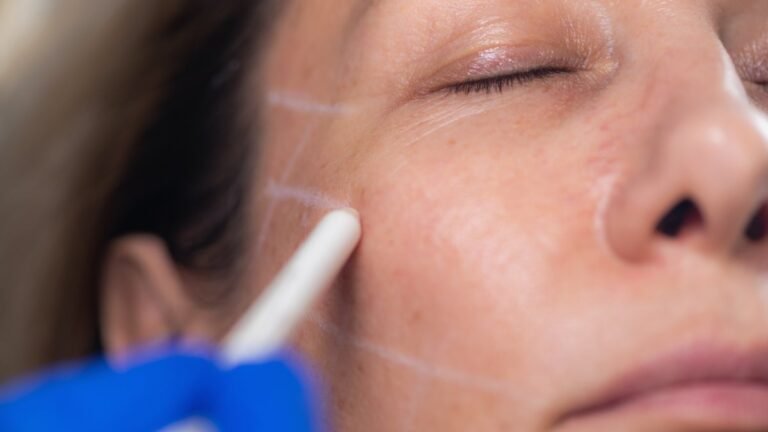 Botox May Give a Mental Health Boost, Study Says – NBC4 Washington