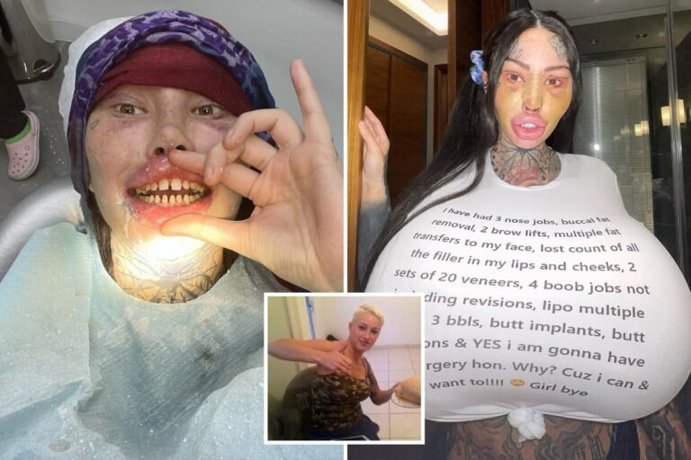 Fans beg Surgery addict TikTok star Mary Magdalene to stop as she unveils ‘extreme’ filed-down teeth