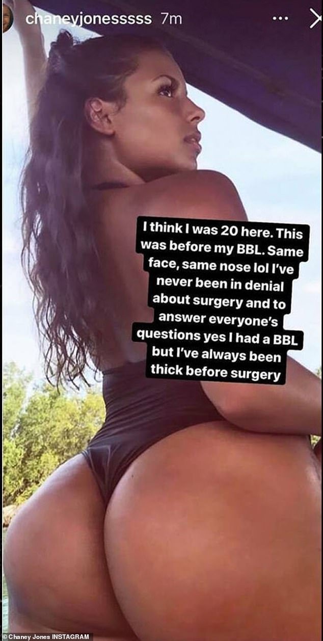 Chaney Jones says she’s never had plastic surgery on her face and posts pics of her pre-BBL body