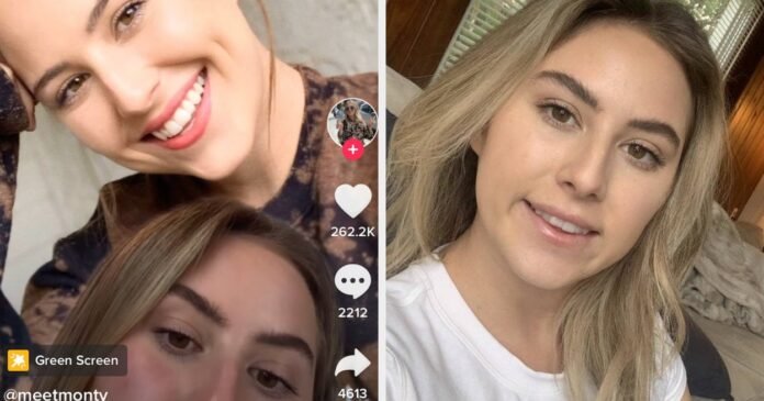 A Woman On TikTok Is Sharing How The Botox She Received For TMJ Botched Her Smile - BuzzFeed