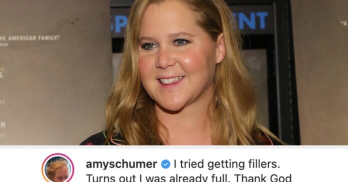 Amy Schumer Explains Why She Removed Her Facial Fillers