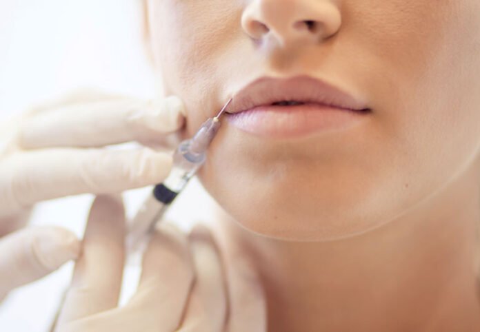 Can a Lip Filler Trigger a Cold Sore? – Cleveland Clinic