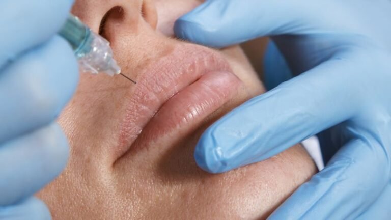 Cosmetic skin fillers rise in popularity, and complications