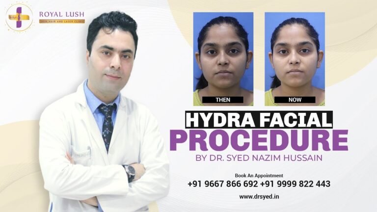 Hydra Facial Treatment Performed In Royal Lush Clinic | Dr. Syed Nazim | Saket | South Delhi