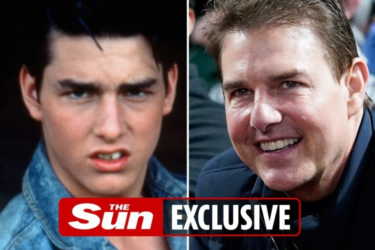 Inside Tom Cruise’s dramatic face transformation as plastic surgery expert says he looks ‘swollen from neck & face lift’