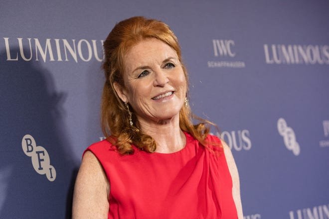 Sarah Ferguson opens up about getting cosmetic procedures done.