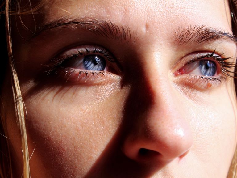 Why Having an Eyelift Is Easier Than You Think, According to a Plastic Surgeon