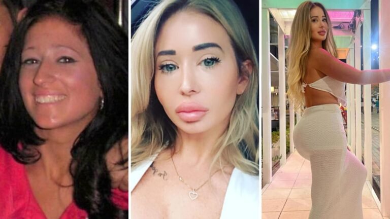 Plastic surgery photos of Aussie woman who spent $100,000 transforming her looks as she reveals two things she’d change