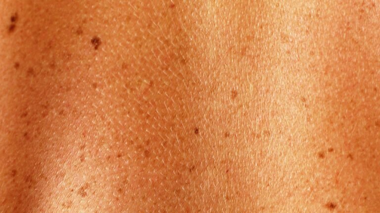 The Ultimate Guide To Checking Your Moles & Knowing Your Body