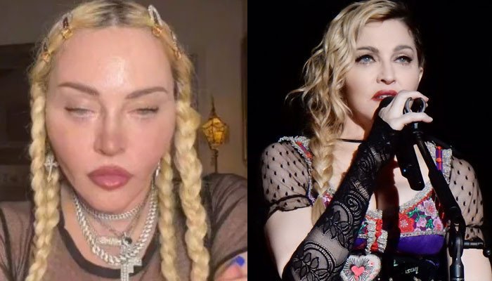 Plastic surgeon points out ‘lots of issues’ on Madonna’s face post bizarre video