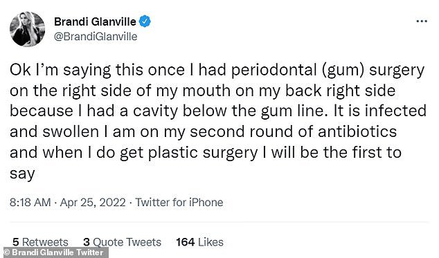 Brandi Glanville DENIES getting plastic surgery