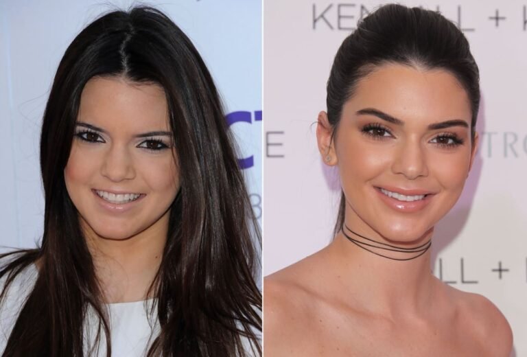 Did Kendall Jenner Get Plastic Surgery? Her Full Evolution Over The Years