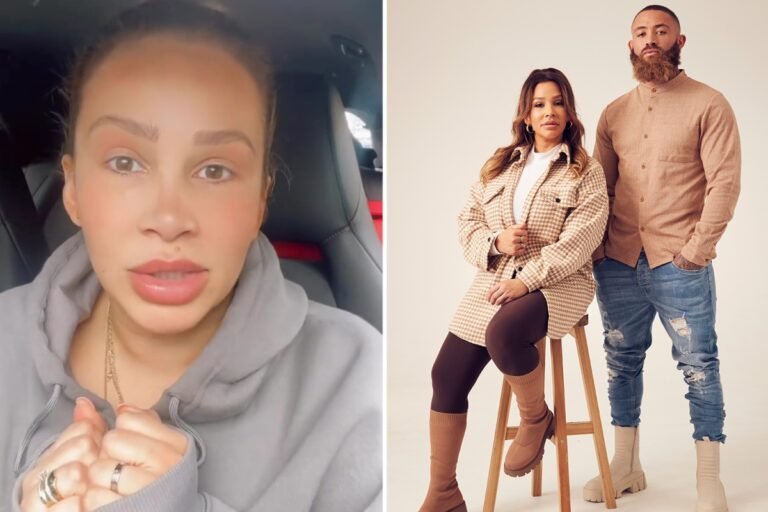 Ashley Cain’s ex Safiyya undergoes Botox and cosmetic treatments in post split makeover