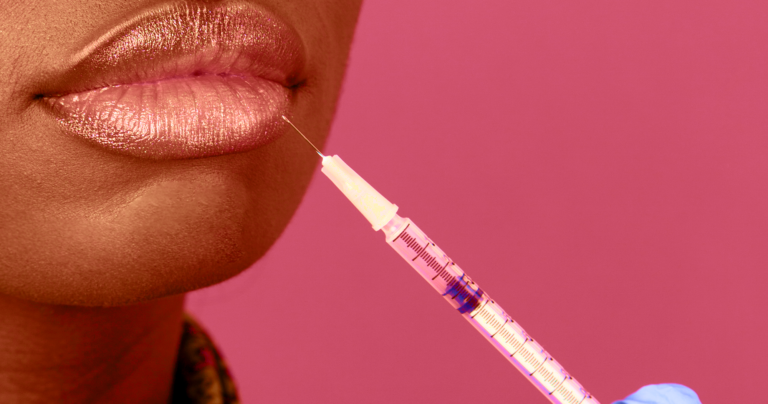 Confessions Of A Lip Filler Doctor