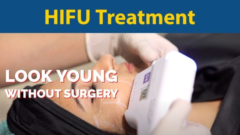 Hifu Treatment – Look young without surgery | HIFU Skin Tightening Procedure | Dr. Jyoti Gupta MD