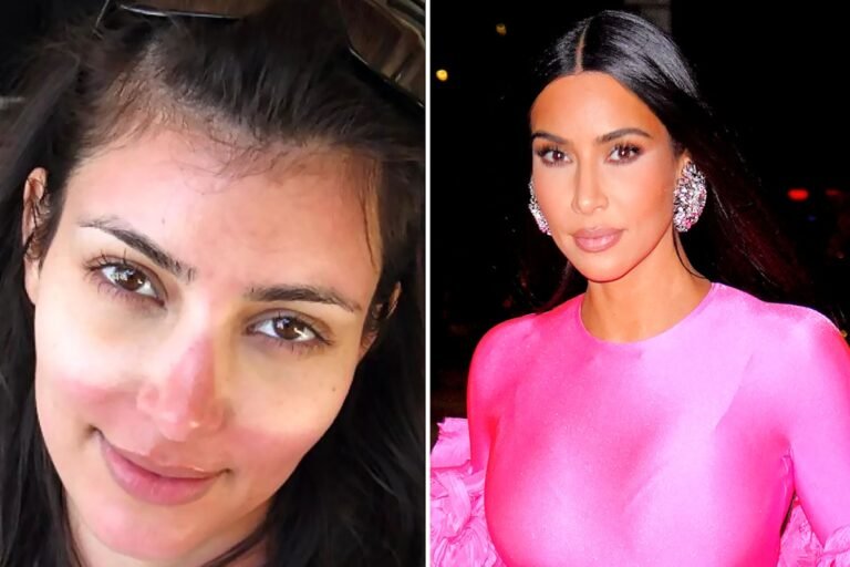 Kardashian fans love unfiltered & candid photo of Kim with severe sunburn on her face in throwback post