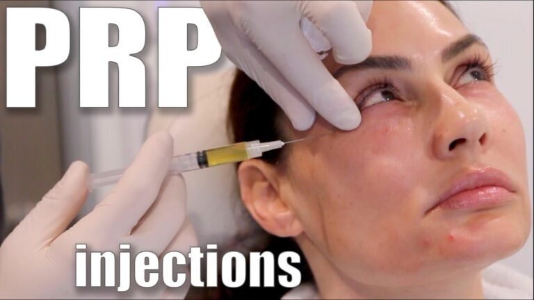 PRP Injections to Face and Neck (Blood Facial)