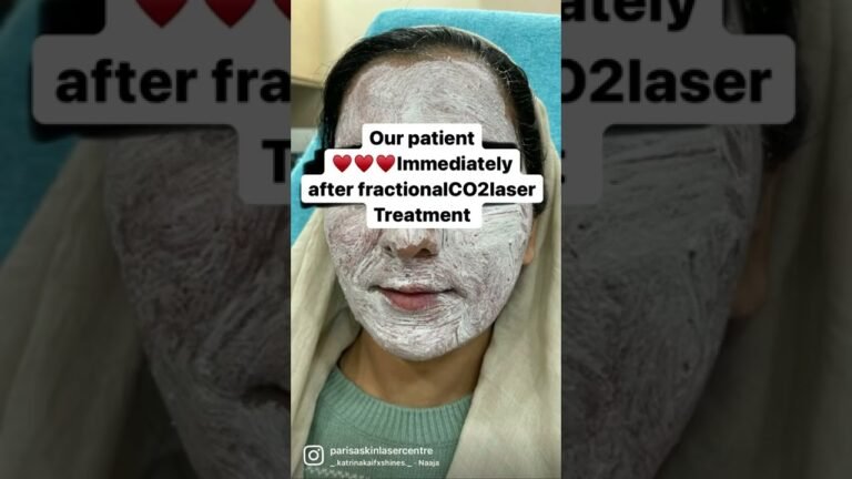 Parisa Bespoke Acne Scars Treatment | Dr Ashima Goel| PARISA skin clinic | Chandigarh | Indiabull