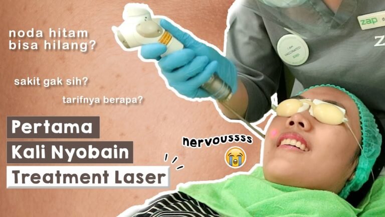 Pengalaman Laser Pertamaku!! Hasil Photo Facial Treatment di ZAP Bagus Gak Ya ?
