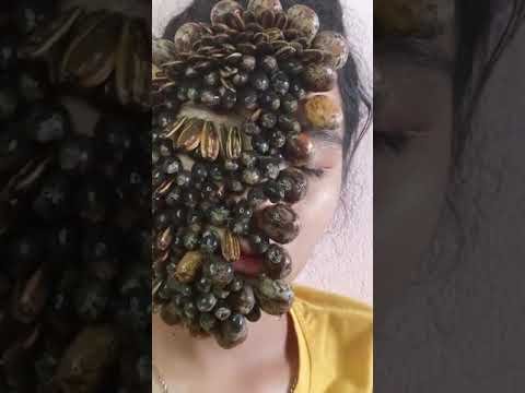 Removing Giant Blood Filled Ticks from Human Girl Face #shorts #ticks