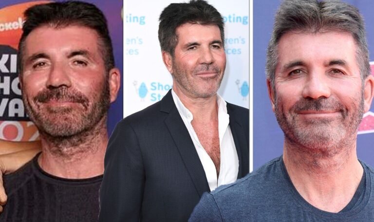 Simon Cowell’s surgery to achieve ageless face ‘hurt like hell’ before swearing off Botox | Celebrity News | Showbiz & TV