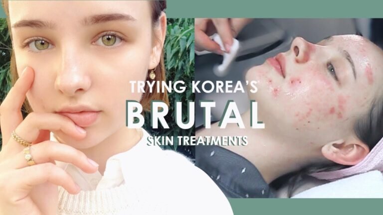 My First BRUTAL Korean Dermatology Experience 💉 #BANOBAGI Laser Treatments | Sissel