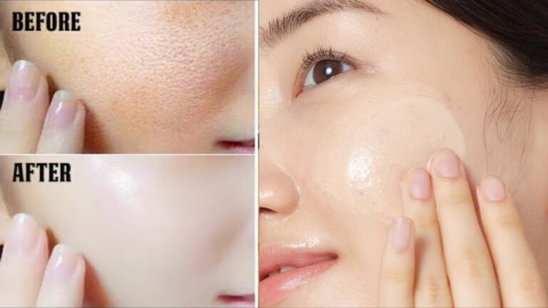 Skin Pores Treatment At Home