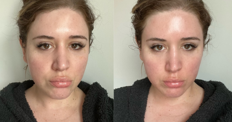 The NuFace Trinity Facial Toning Device Convinced Me To Quit Botox