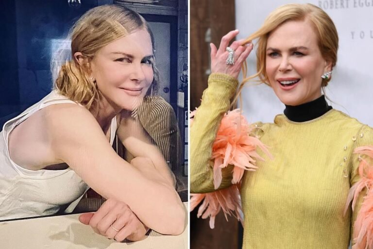 Fans accuse Nicole Kidman of changing face: ‘You don’t look you’