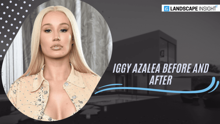The Debate Over Cosmetic Surgery Has Ignited Due to Iggy Azalea’s Sorcerous Glow Up