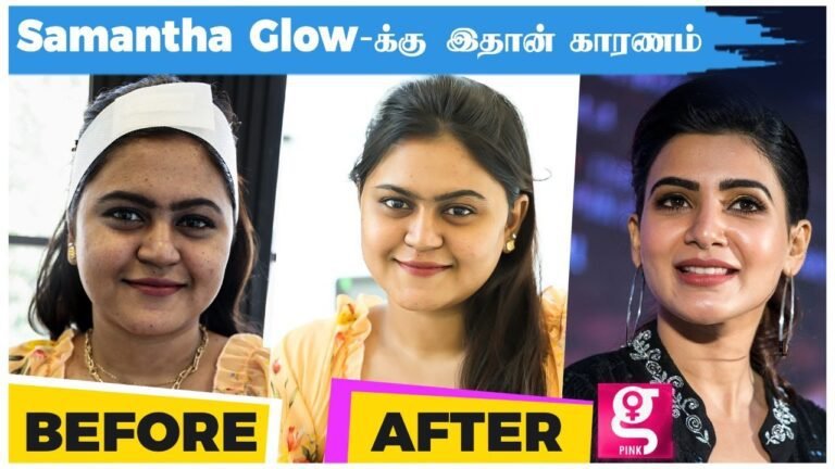 30 Minutes-ல செம்ம Glow | Hydra Facial Treatment | Instant Glow Like Celebrities | Skincare Secrets