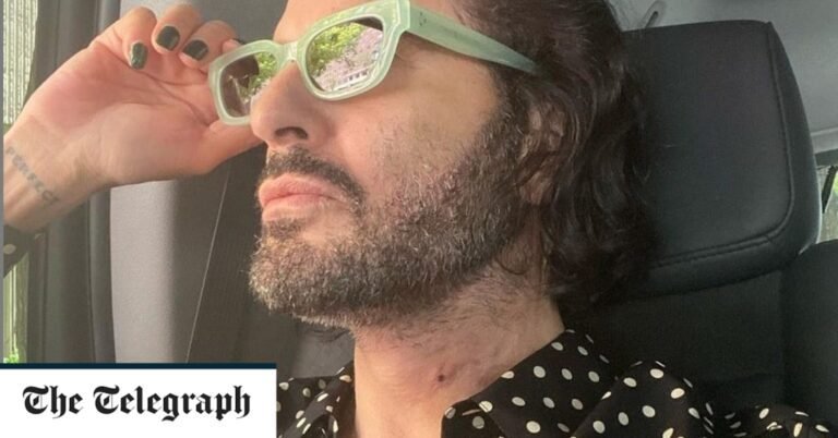 As Marc Jacobs admits to a facelift, is it better to be honest about cosmetic surgery and tweakments?