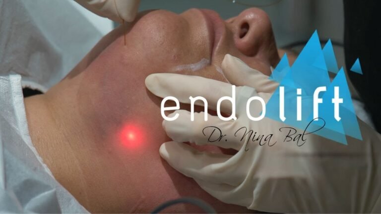 Endolift, The Non Surgical Face Lift Treatment by Dr Nina Bal | Skin Tightening Before and After 💕